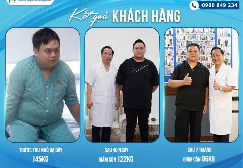 Hành Trình Giảm 59kg Sau 7 Tháng Của Chàng Thanh Niên 28 Tuổi Nhờ Phẫu Thuật Thu Nhỏ Dạ Dày